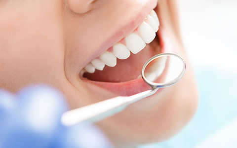 Check-Up & Clean - Teeth Cleaning