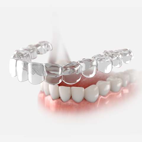 Invisalign Treatment