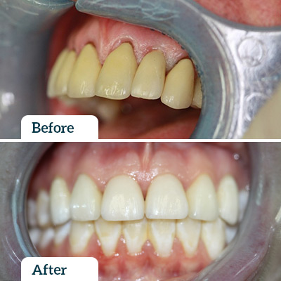 Before & After by Dr Chris Karikios