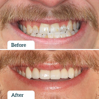 Before & After by Dr Chris Karikios