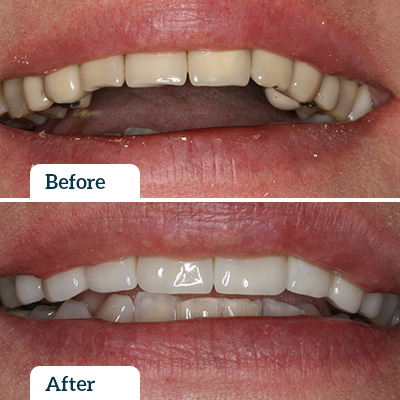 Before & After by Dr Rod Wills