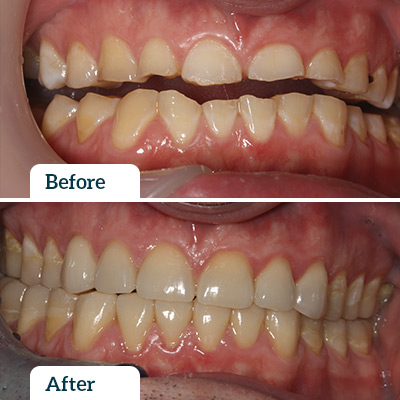 Before & After by Dr Rod Wills