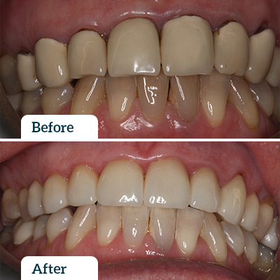 Before & After by Dr Rod Wills